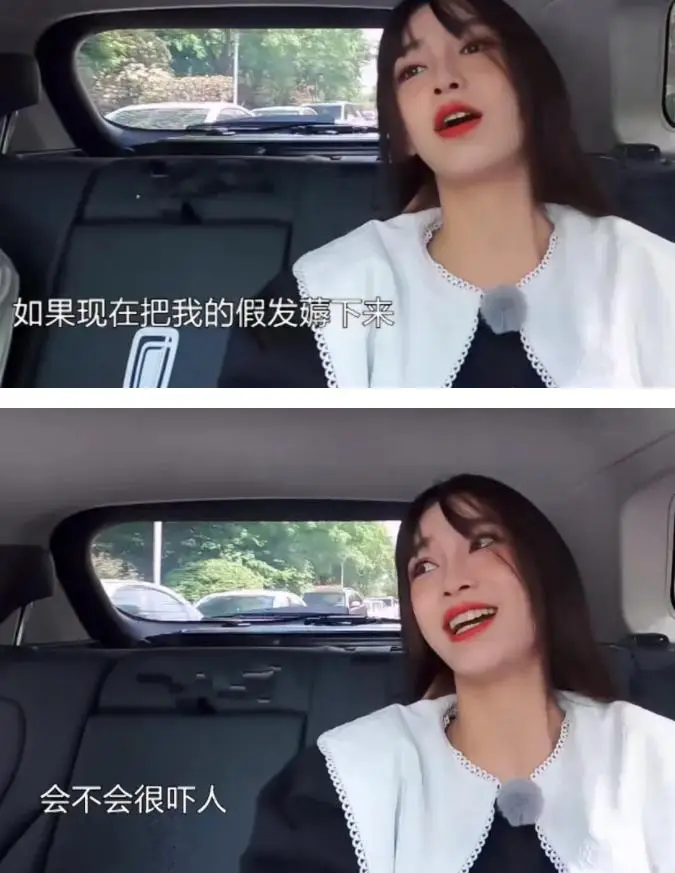 发量少的女明星有哪些_杨幂赵丽颖金晨假发片_女明星脱发严重